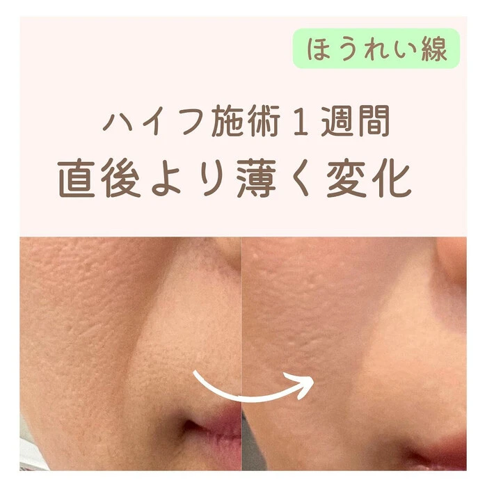 画像254