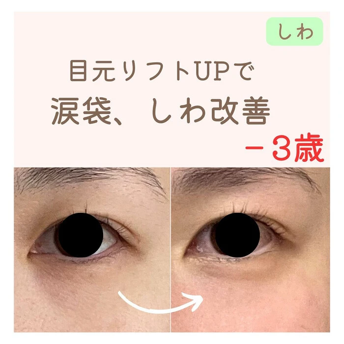 画像260